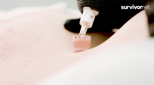 SURVIVORNET – NIPPLE TATTOO